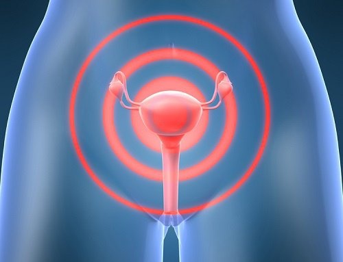 Cancro al collo dell'utero: origine e prevenzione
