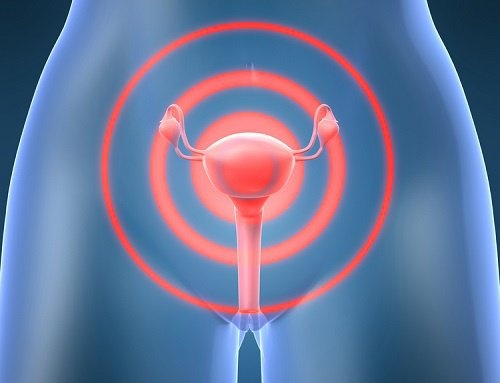 esiste una condizione conosciuta come prolasso uterovaginale