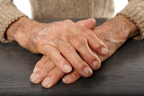 Farmaci contro artrosi alle mani