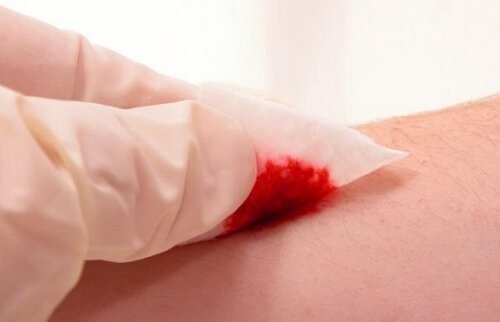 ferita sangue dermatologo