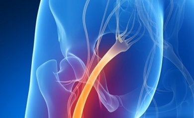 Soffrite di sciatica? Ecco 5 indizi per scoprirlo