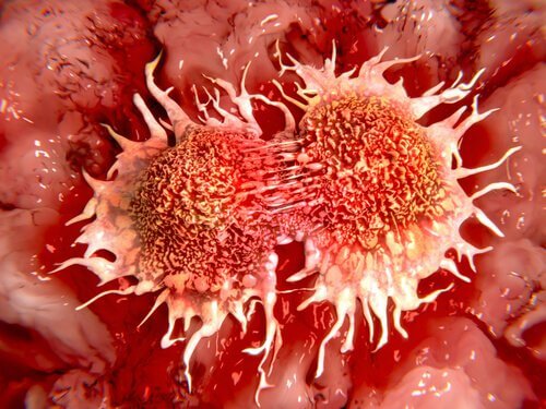 cellule cancerogene cancro al colon