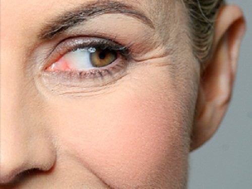 usi cosmetici dell'aceto di mele per combattere le rughe