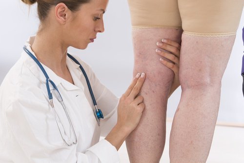 Dottotressa che controlla le gambe di una paziente