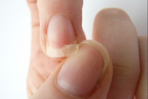Soluzioni per le unghie fragili