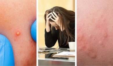 7 prove che indicano che lo stress vi sta danneggiando