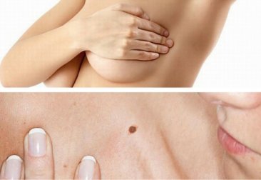 4 autoesami che potrebbero salvarvi la vita