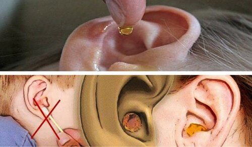 Cerume nelle orecchie: come eliminarne l'eccesso in modo naturale
