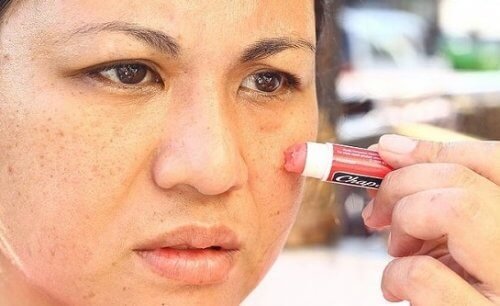 Pelle protetta e burrocacao