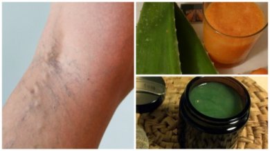 Antica ricetta della nonna contro le vene varicose