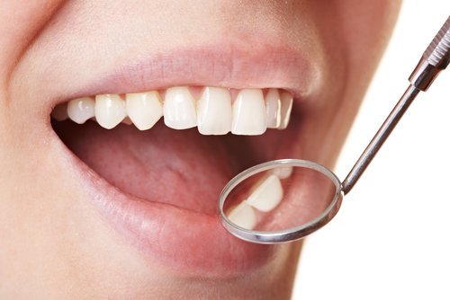 Igiene dentale