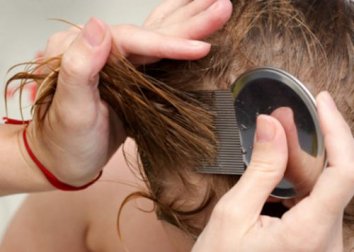 7 rimedi naturali per eliminare i pidocchi