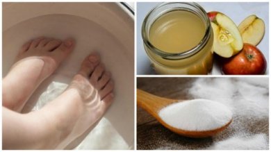 Micosi alle unghie: due ingredienti per eliminarla