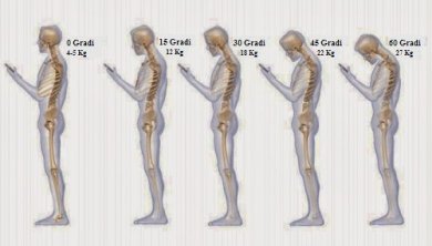 6 abitudini che provocano dolore al collo
