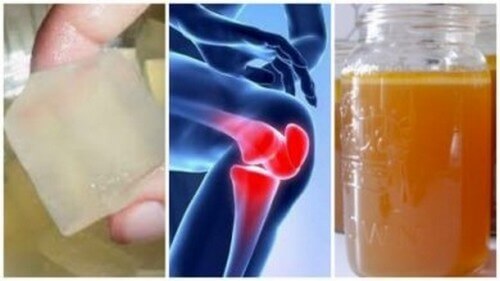 3 rimedi alla gelatina contro i dolori articolari