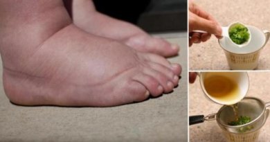 Scoprite uno dei migliori rimedi contro i piedi gonfi