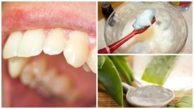 Placca dentale: rimuoverla in modo naturale