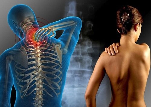 Sapevate che esiste una relazione tra glutine e fibromialgia?