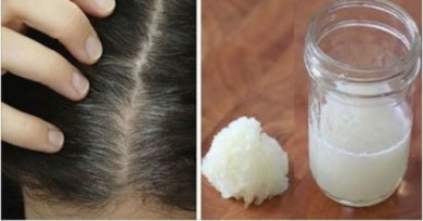 Trattamento naturale per alleviare la caduta dei capelli
