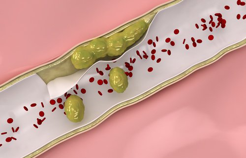 Pulire le arterie con alcuni alimenti