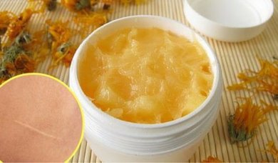 Cicatrici: ridurle con una crema naturale