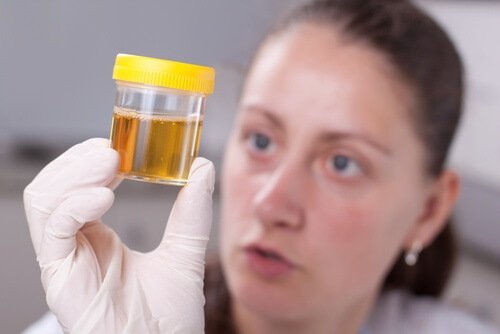 un cambiamento nel colore delle urine può indicare un problema al fegato