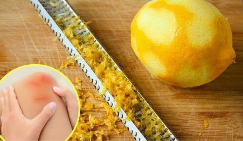 Scorza di limone per calmare il dolore alle articolazioni