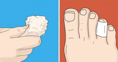 Calli ai piedi: 6 rimedi naturali per eliminarli
