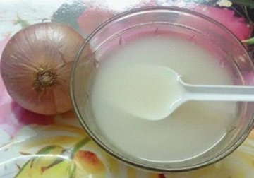 Eliminare i calli ai piedi con cipolla e aceto bianco