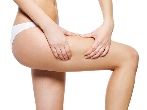 Cellulite