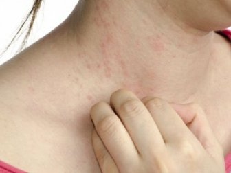 I sintomi del diabete, i 5 meno conosciuti