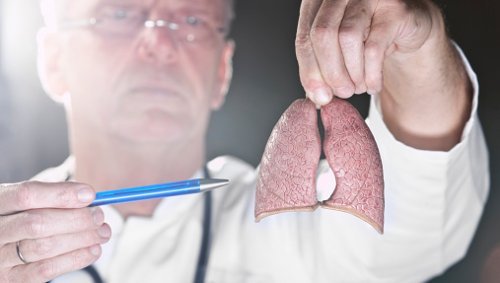 cancro-ai-polmoni