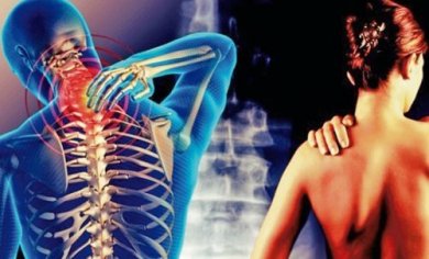 Cervicobrachialgia: quel dolore che va dal collo al braccio