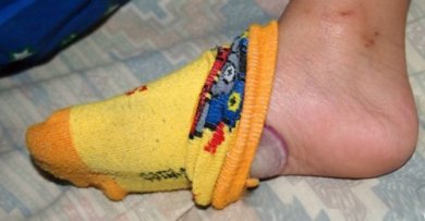 Dormire con una cipolla sotto i piedi: 4 benefici