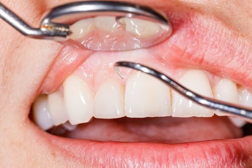 Dentista controlla le gengive