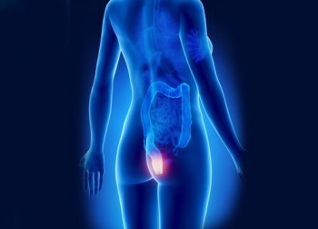 Emorroidi: 9 rimedi naturali per curarle