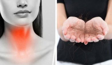 Problemi tiroidei: 8 consigli contro la caduta dei capelli