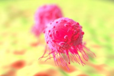 Nuovo trattamento sostitutivo alla chemioterapia