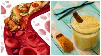 5 rimedi naturali per prevenire l'occlusione delle arterie