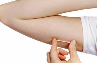Impianti contraccettivi sottocutanei: tutto quello che c'è da sapere