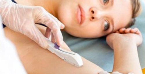 Posizionamento impianti contraccettivi sottocutanei