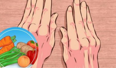 Alimenti contro l'artrite da includere a colazione