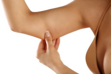 Come eliminare la flaccidità delle braccia
