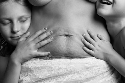 accettare il proprio corpo