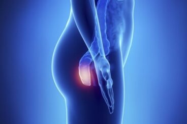 Sintomi del tumore dell'ano, la malattia silenziosa