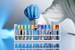 HIV: virus eliminato dal sangue di un paziente inglese