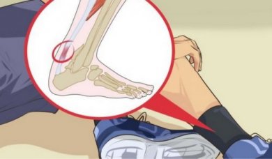 Tendine d'Achille: 5 rimedi in caso di infiammazione