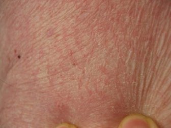 Creme per la pelle secca: preparatene in casa 5