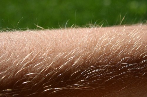 peli superflui sulle braccia