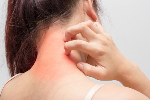 Eczema e disturbo intestinale
